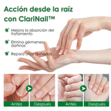 ClariNail™ – Tratamiento Antihongos de Uñas con Resultados Visibles - ClickBag