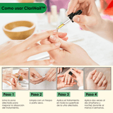 ClariNail™ – Tratamiento Antihongos de Uñas con Resultados Visibles - ClickBag