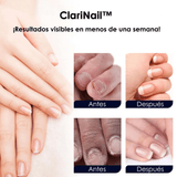 ClariNail™ – Tratamiento Antihongos de Uñas con Resultados Visibles - ClickBag