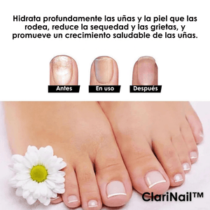 ClariNail™ – Tratamiento Antihongos de Uñas con Resultados Visibles - ClickBag