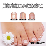 ClariNail™ – Tratamiento Antihongos de Uñas con Resultados Visibles - ClickBag