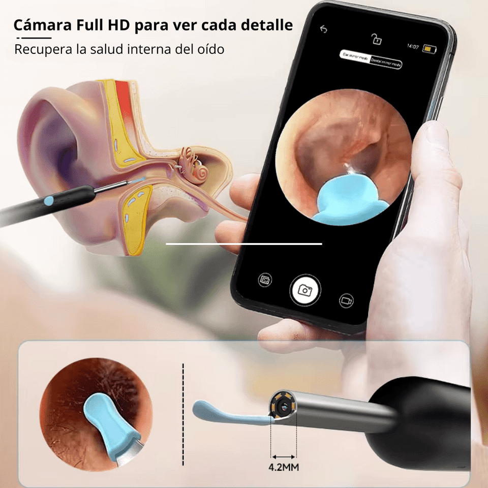 ClearScope™ – Limpieza profunda de oidos con visión HD - ClickBag