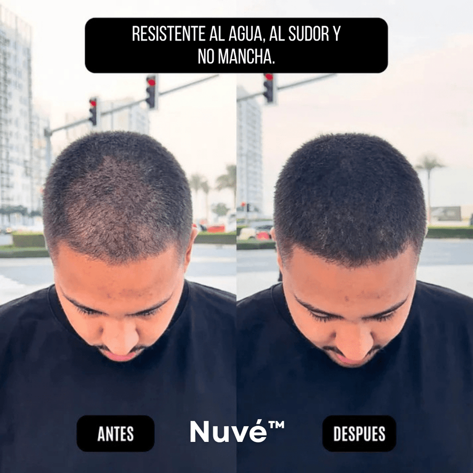 Nuvé™ – Oculta la Pérdida Capilar en Segundos - ClickBag