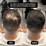 Nuvé™ – Oculta la Pérdida Capilar en Segundos - ClickBag