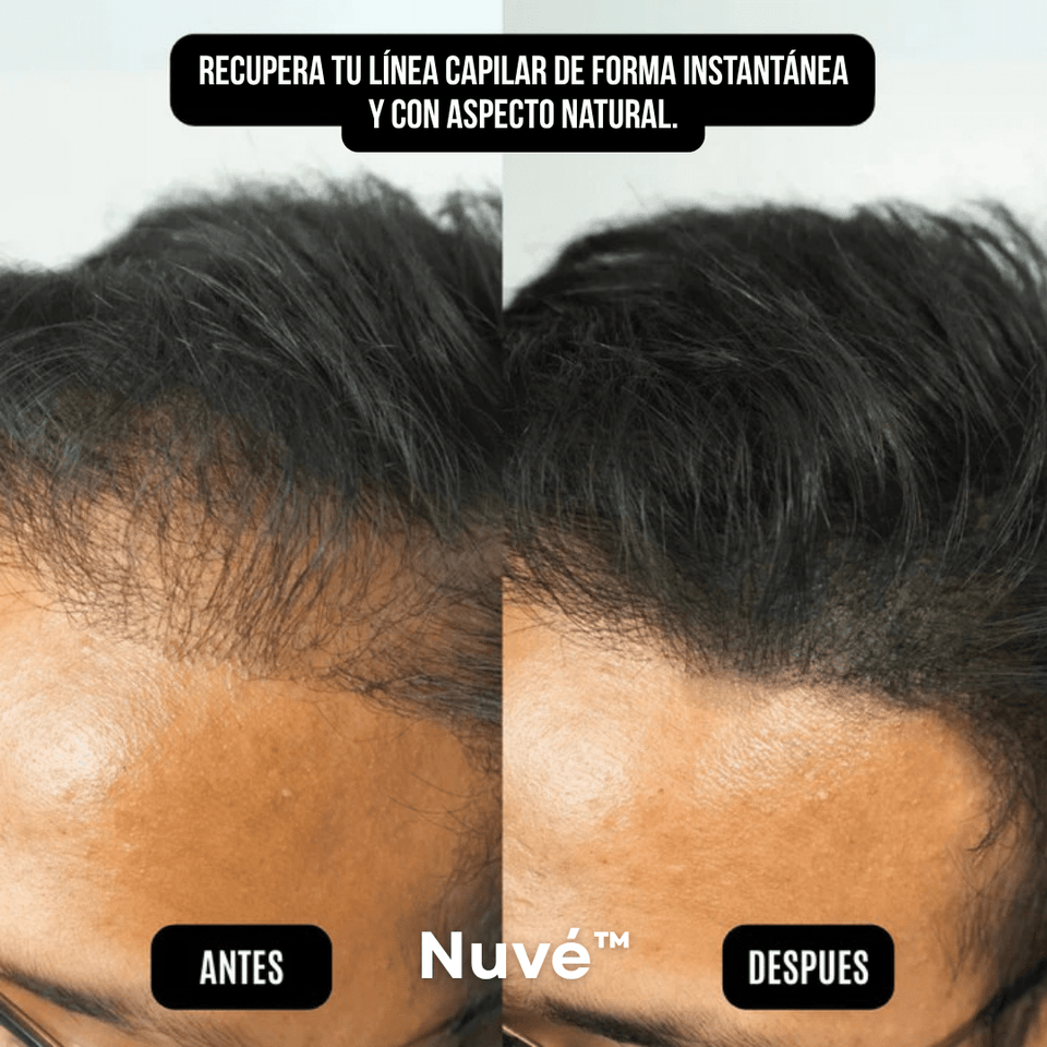 Nuvé™ – Oculta la Pérdida Capilar en Segundos - ClickBag